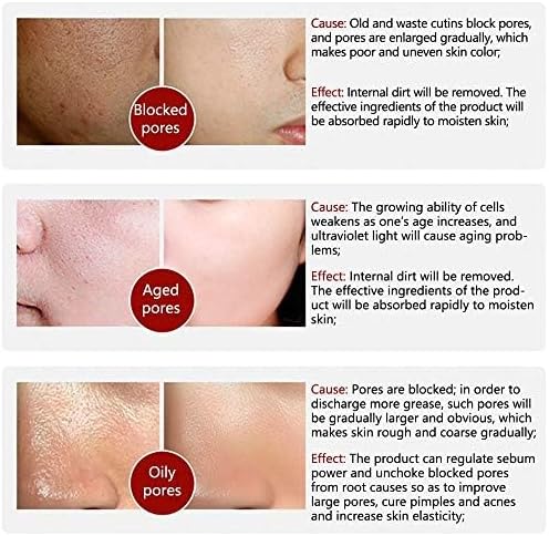 LANBENA Original Pore Solution Serum