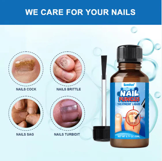 Sumifun – Anti Fungal Nail Repair Solution (Original)
